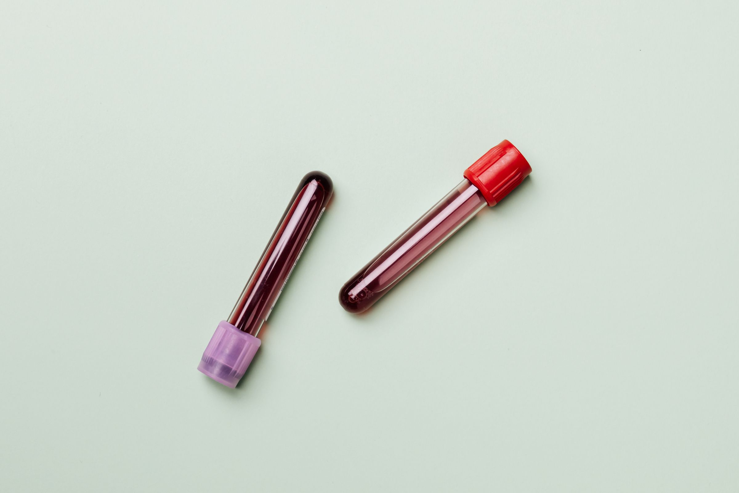 MH1b_pair_lab-blood-tubes